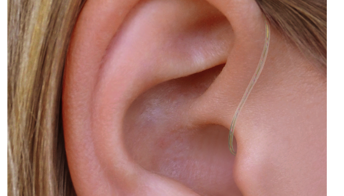 Widex: Ein Ohr mit Ric-Hörgerät am Ohr