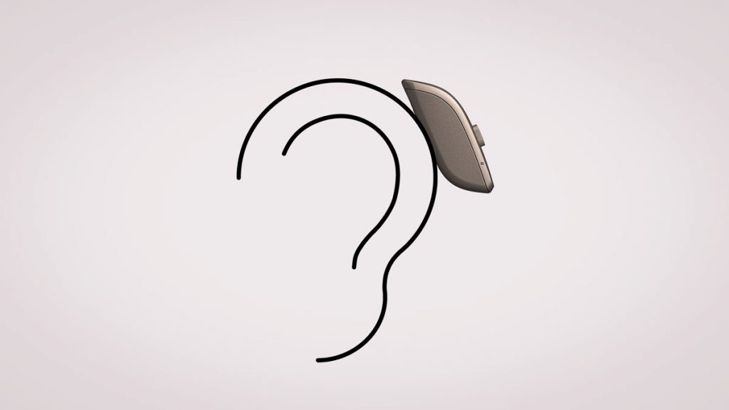 ReSound One: Hörgeräte mit 5 Neuheiten und einem verblüffenden Feature 13 ReSound One mit nur einem Auflagepunkt am Ohr (Skizze)