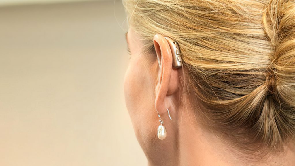 Bernafon Viron: Weicher Klang und deutliche Sprache 11