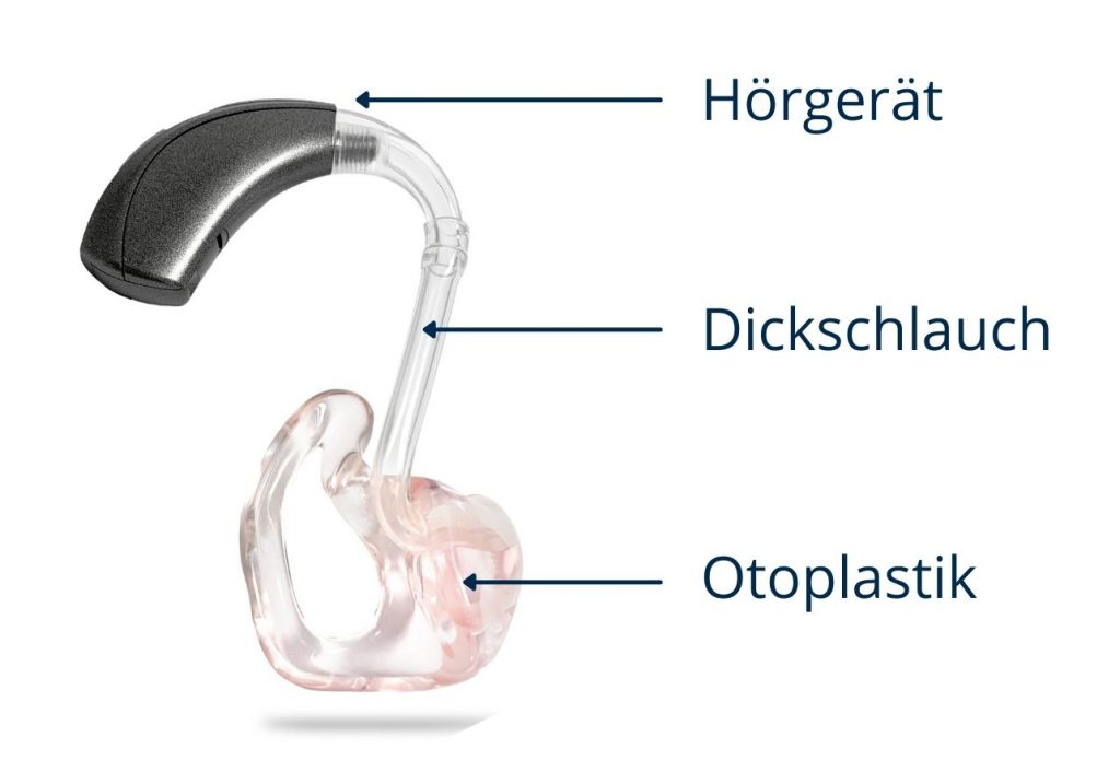 Hörgeräte 2025: Alles, was Sie wissen müssen 3 Dickschlauch-Hörgerät mit Beschriftung
