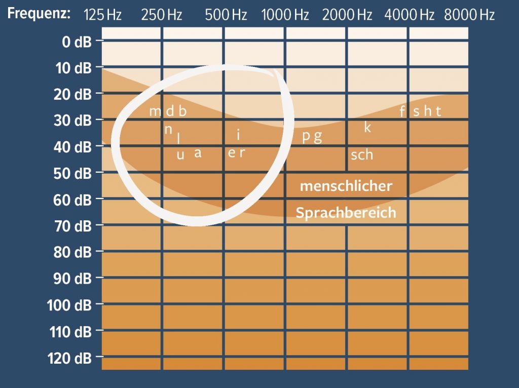 Audiogramm mit Sprachfeld, die hochtönigen Phoneme sind markiert