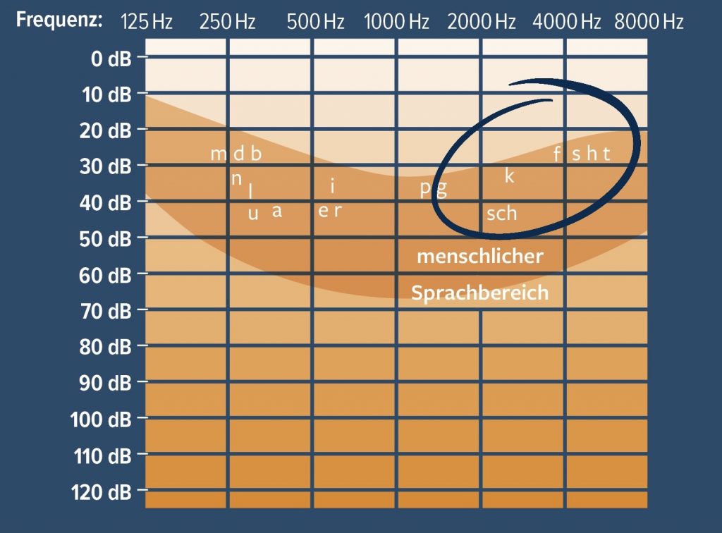 Audiogramm mit Sprachfeld: Die tieftonigen Phoneme sind markiert.