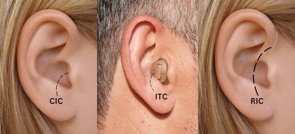 Mini Hörgeräte 2025: die besten kleinen Hörgeräte im Vergleich 2