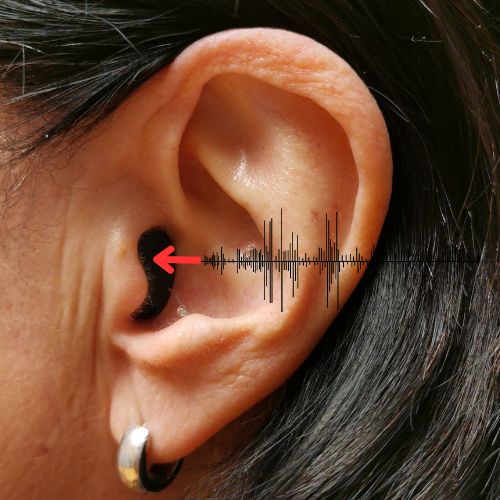 Telefonieren mit dem Hörgerät - Tipps und Tricks 2025 11