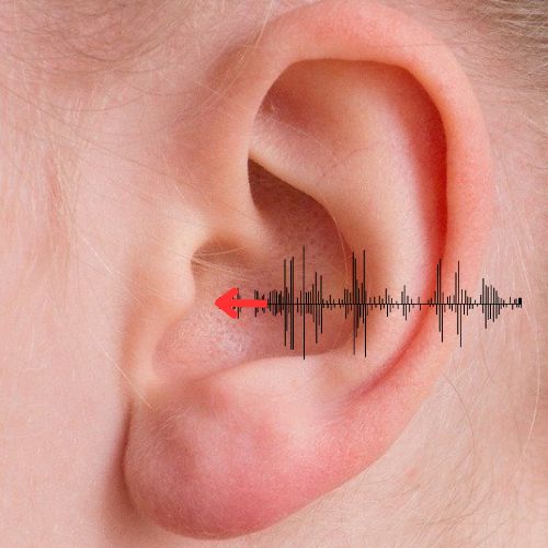 Telefonieren mit dem Hörgerät - Tipps und Tricks 2025 10