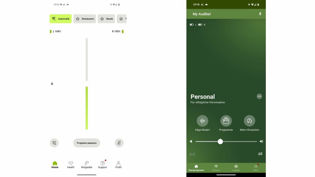 Starkey Edge AI vs. Phonak Infinio Sphere - der große Direktvergleich 2025 13